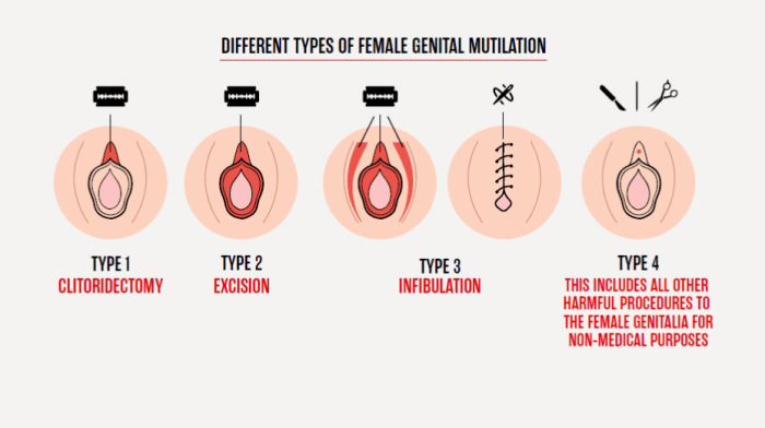 Understanding and Combating Female Genital Mutilation (FGM)