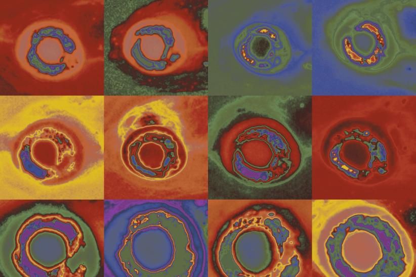 Psilocybin-Assisted Therapy: Transforming Mental Health and Addiction Recovery with Lasting&nbsp;Benefits