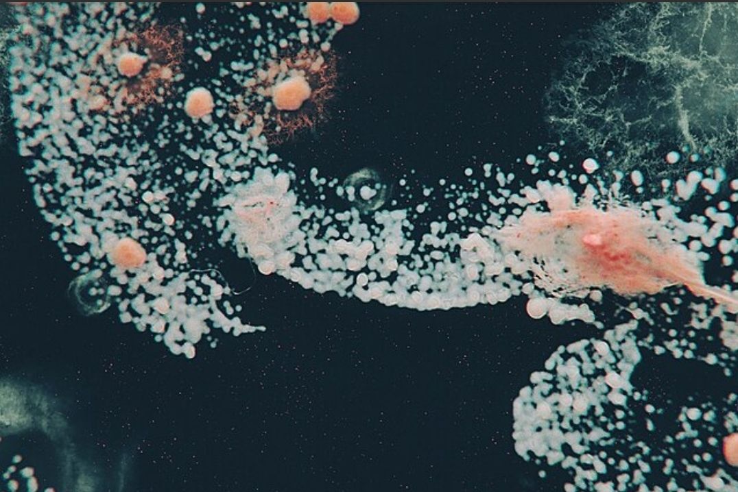 Meeting Myself Across Universes: A Journey Through the Infinite