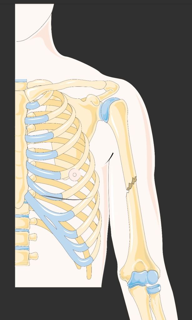 The Osteology of the Soul: Have You Ever Broken a Bone?