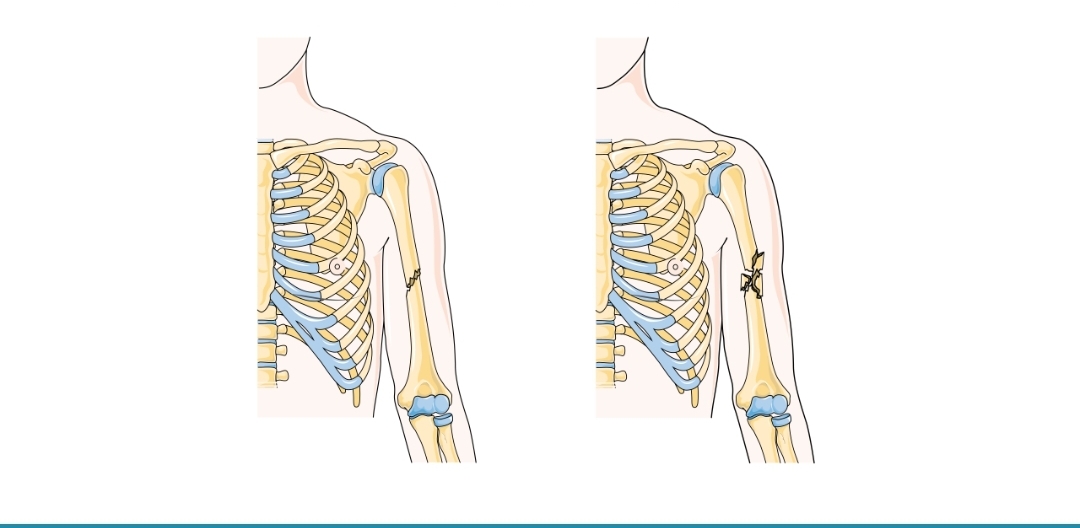 The Osteology of the Soul: Have You Ever Broken a Bone?