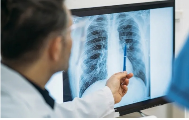 Popcorn Lung: The Hidden Danger Behind Flavored Vaping and Industrial Chemicals