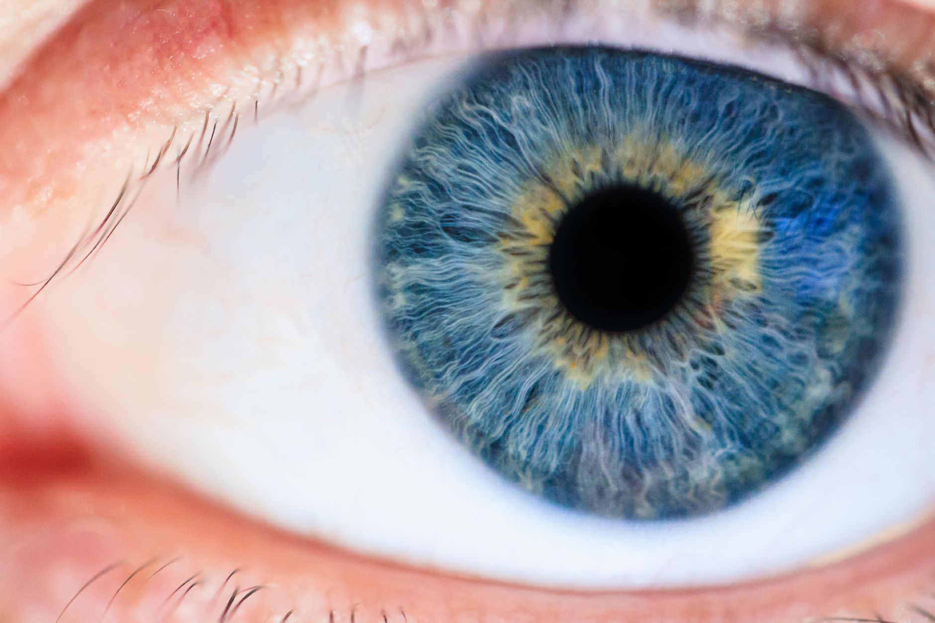 One-Time Gene Therapy for Wet AMD Could Redefine Vision Care Beyond Lifelong Eye Injections