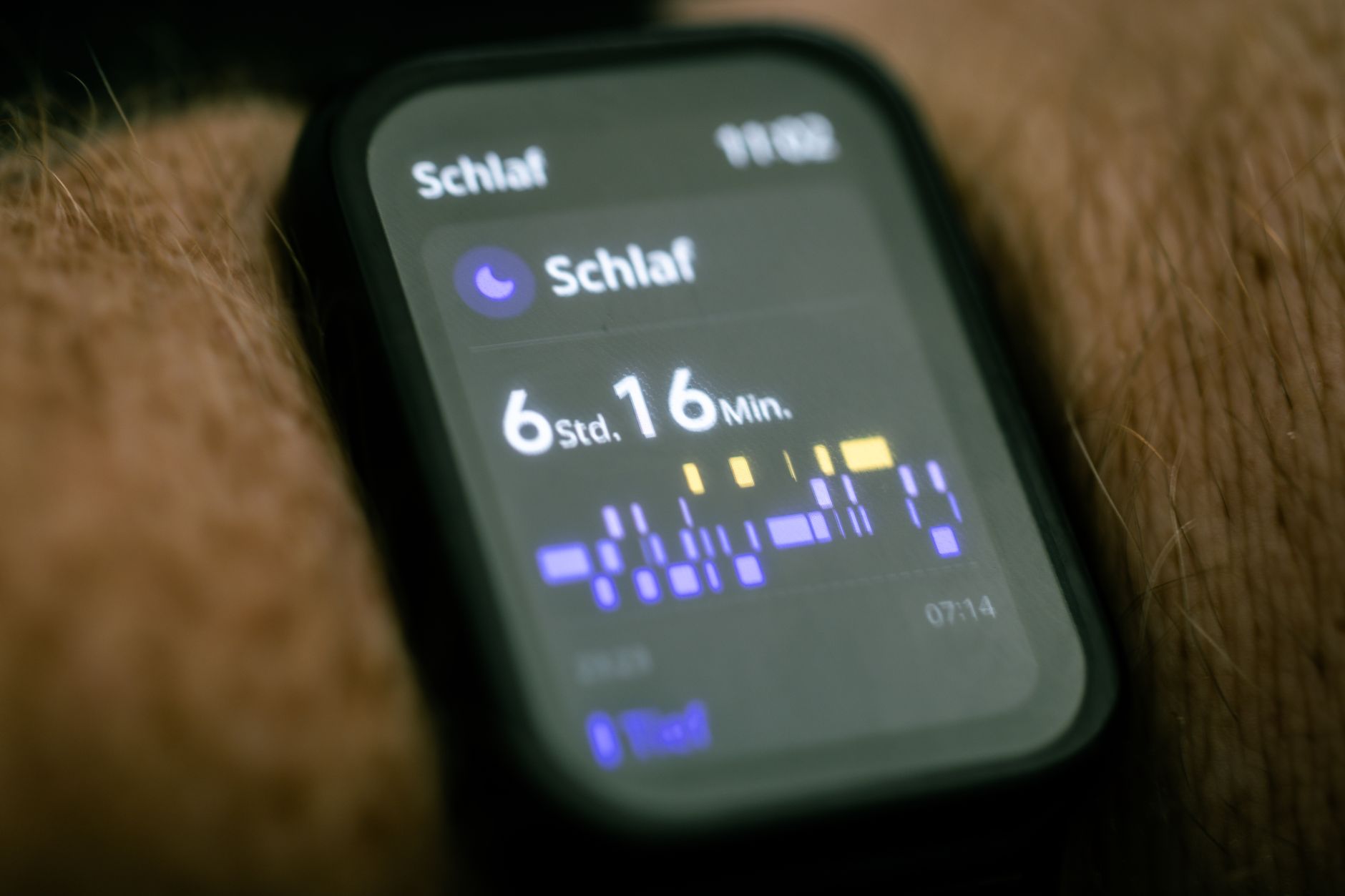 Wearable Wellness Technology: Why Everyday Wellness Is Becoming More Passive Than Active